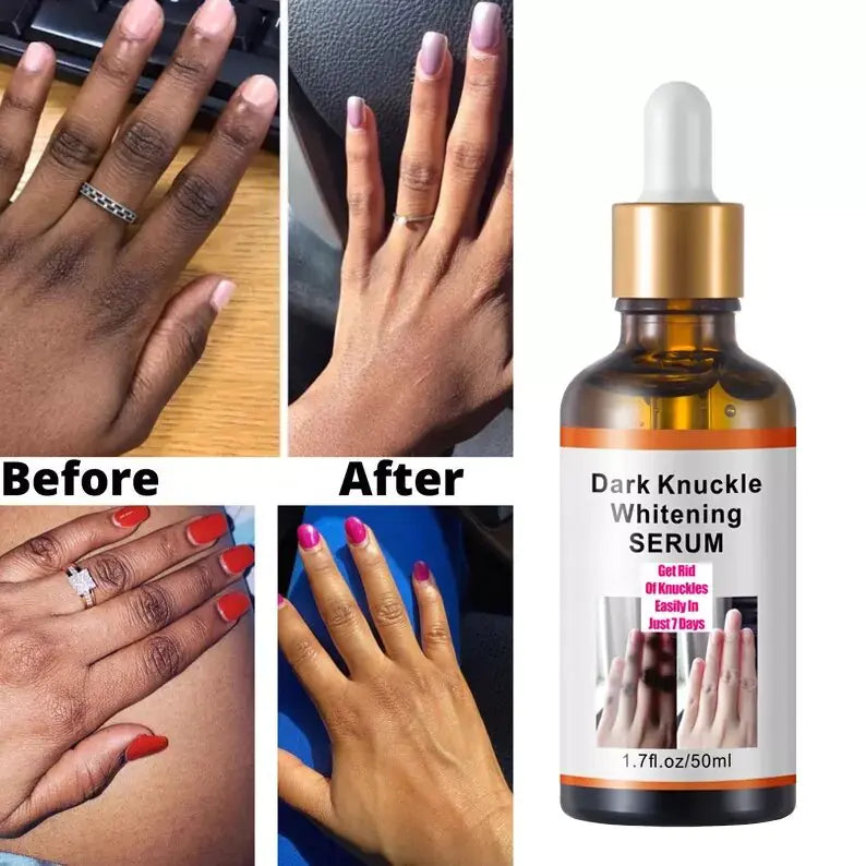 Intense Knuckle Whitening Serum